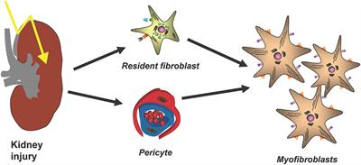 New Aspects of Kidney Fibrosis–From Mechanisms of Injury to Modulation of Disease